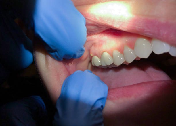 Best Emergency Dental Services for Seniors in Murfreesboro, NC