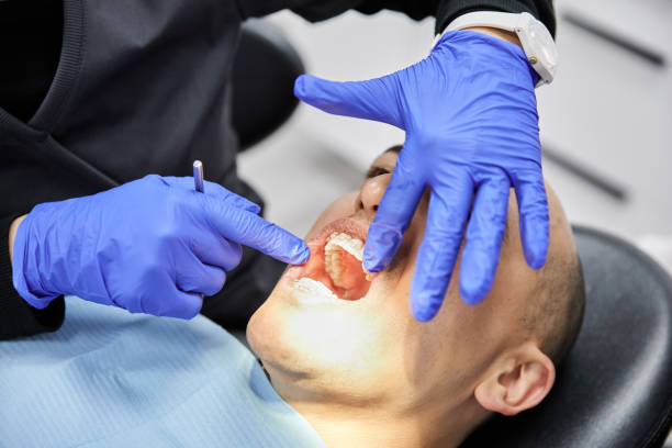 Best Broken or Cracked Tooth Emergency Dentist in Murfreesboro, NC