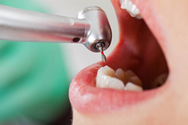 Best Mobile Emergency Dentist in Murfreesboro, NC